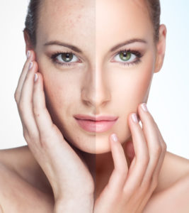 image-of-woman-with-split-face-down-the-middle-sun-damage