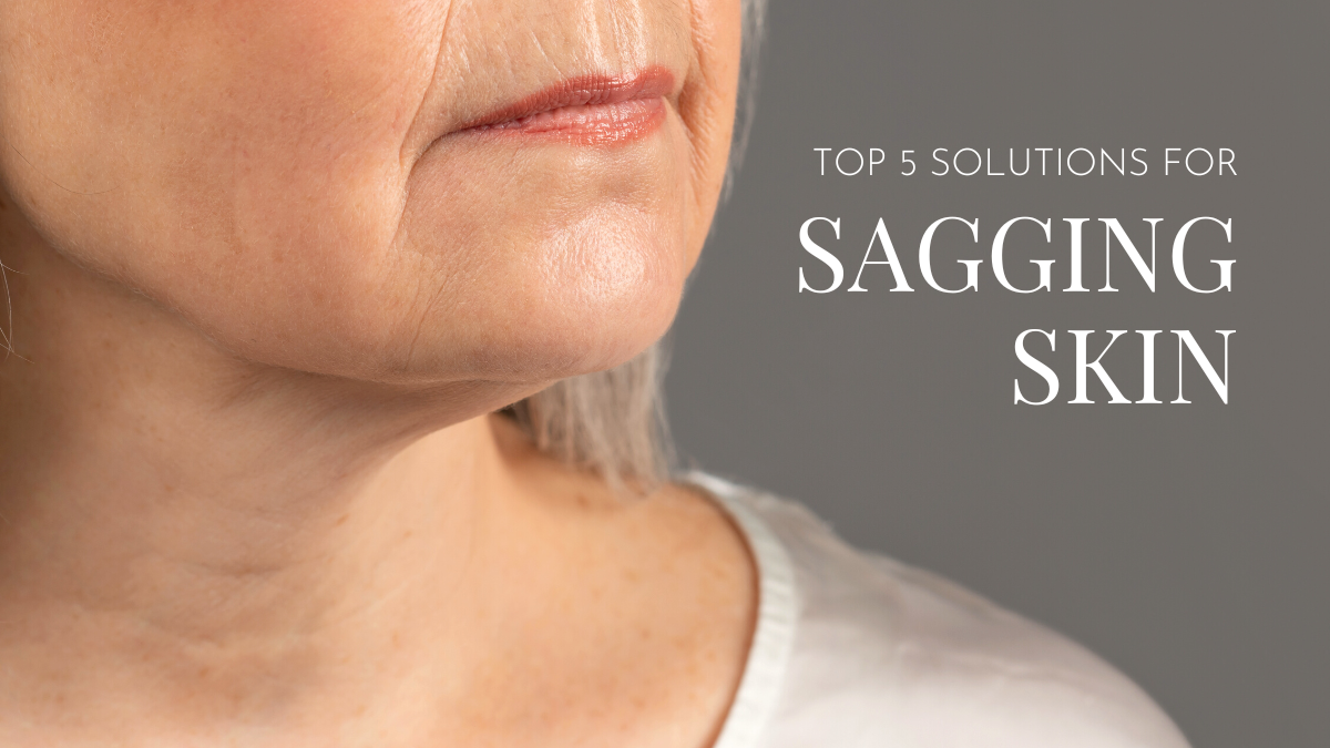 Top 5 Solutions For Sagging Skin Santa Barbara